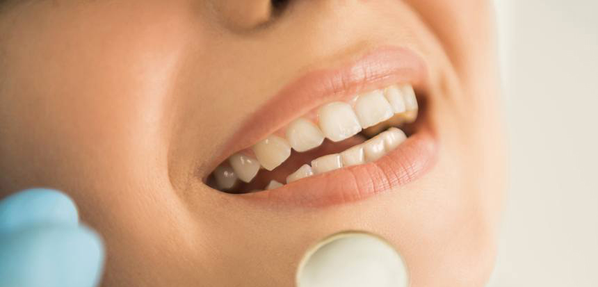 6-Proven-Tips-To-Look-After-Your-Teeth.jpg