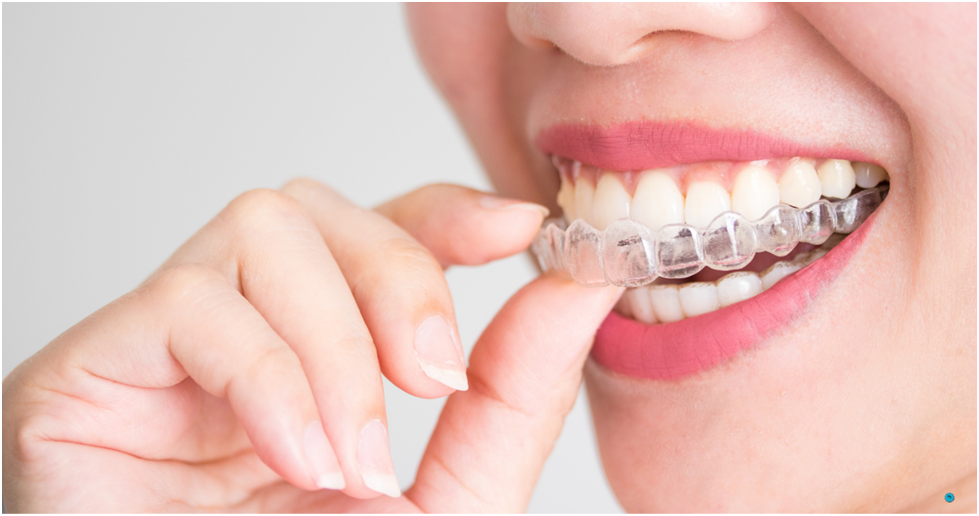 Invisalign for Adults: Straightening Teeth Without Disruption to Your Lifestyle